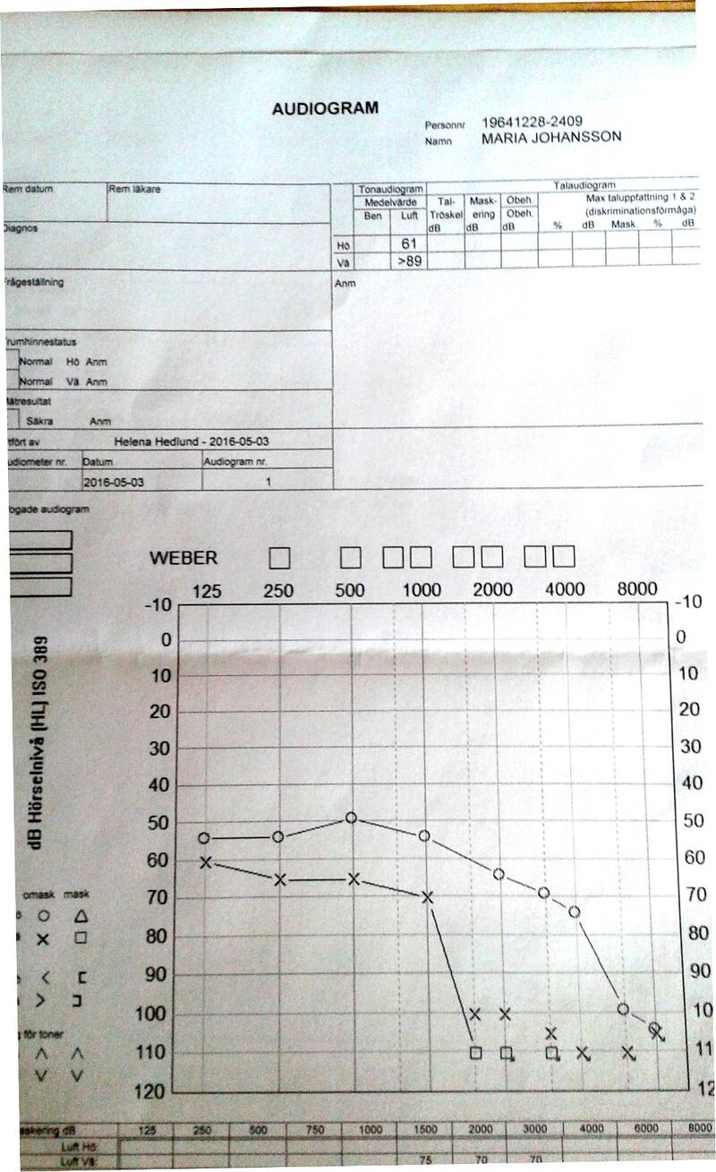 Före bönen. Maria Johanssons audiogram från 3 maj 2016. Lägsta förmåga att uppfatta ljud ligger på omkring 60 db (lodrät axel). God hörsel = lågt decibeltal. O = hörsel på höger öra. X = hörsel på vänster öra. Vågrät axel anger ljudets frekvens. 