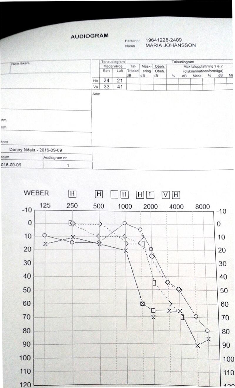 Efter förbönsgudstjänst. Maria Johanssons audiogram från 9 september 2016. Hennes lägsta förmåga att uppfatta ljud ligger numera på 10 db.